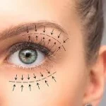 بیهوشی در جراحی افتادگی پلک؛ واقعیت یا تصور رایج؟