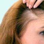 هفت راز علمی برای جلوگیری از ریزش مو در زنان و کمبودهایی که نباید نادیده بگیرید