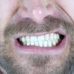 این میوه تهدید پنهان برای دندان‌ها است