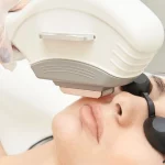 لیزر موهای زائد بعد از عمل بینی