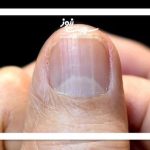 حقایقی درباره هاله ناخن‌ها