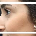 چرا بینی قوز دار مد 2026 شد