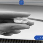 کلینیک مدرن مرکز تخصصی انجام اینلی و آنلی دندان در سراسر ایران